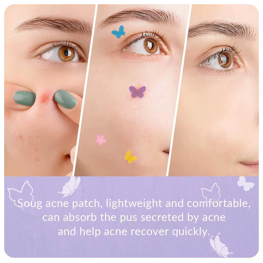 Butterfly Shape Acne Pimple Patch Stickers Blemish Spot Concealer Cover 0.1Mm Acne Treatment Pimple Remover Skin Care